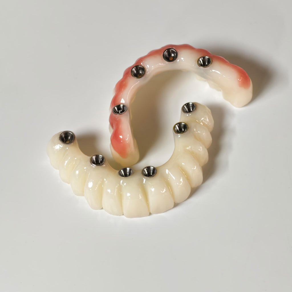 Full-Arch PMMA Bridge With Ti-Base Screw Retained