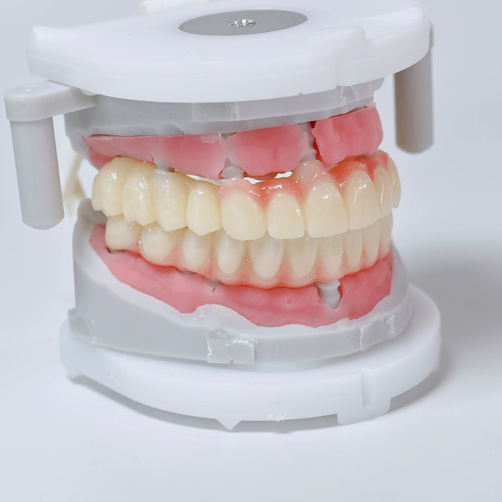 Full-Arch Zirconia Bridge And PMMA Bridge With Cement Retained