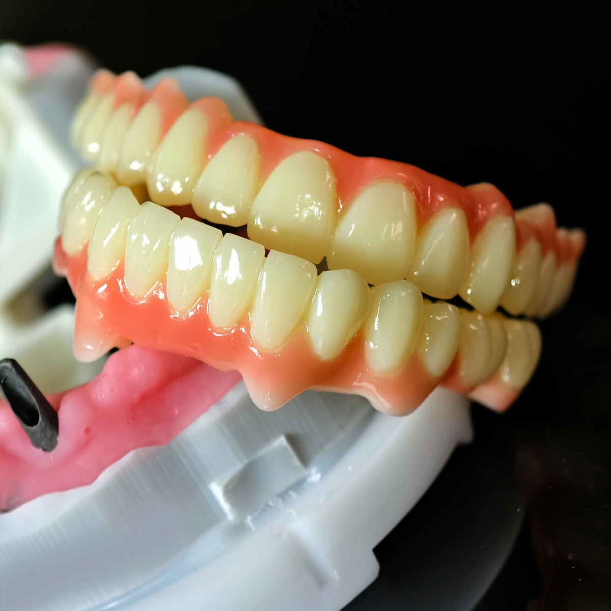 Full=Arch Pmma Bridge With Cement Retained