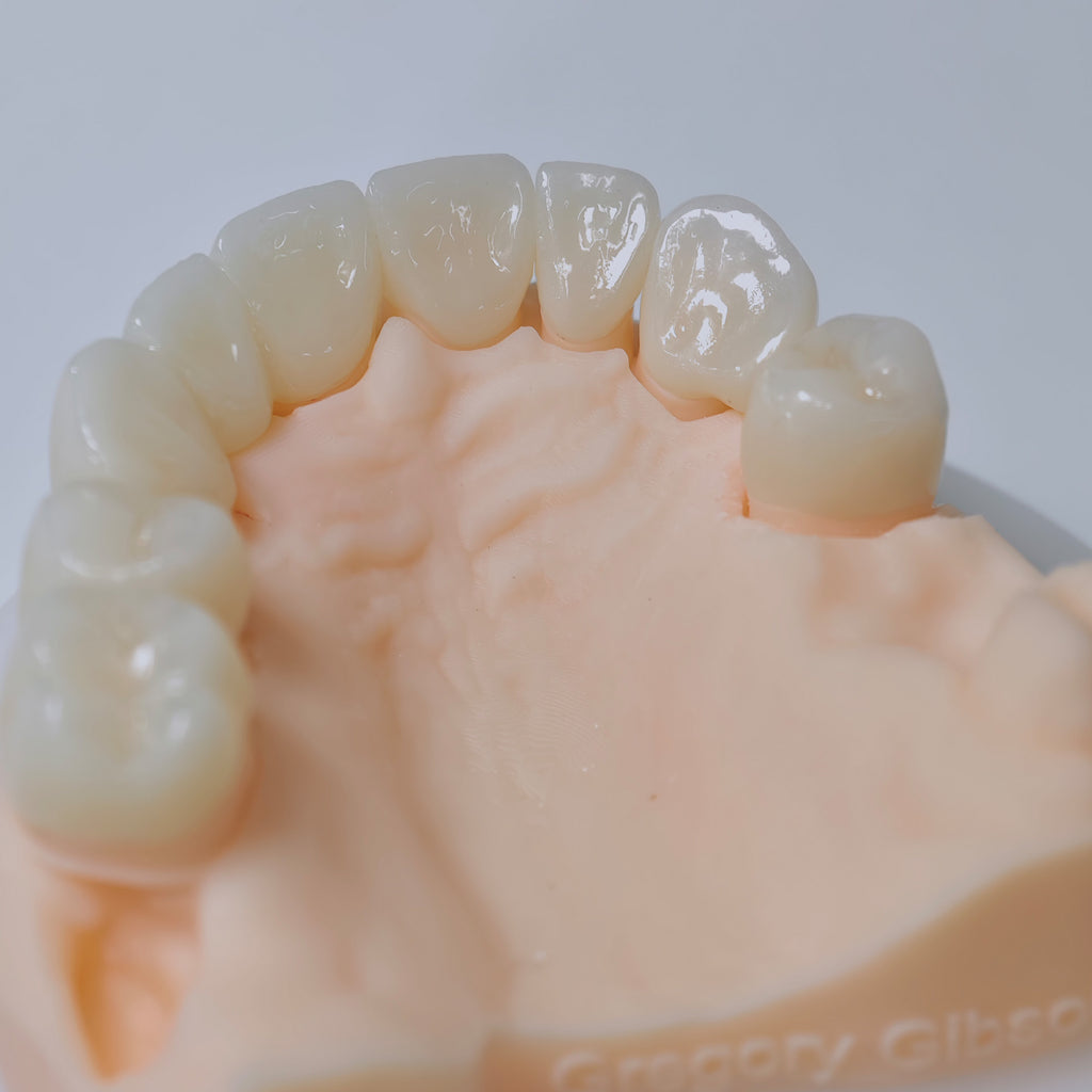 High - Strength Zirconia Bridge And Crown