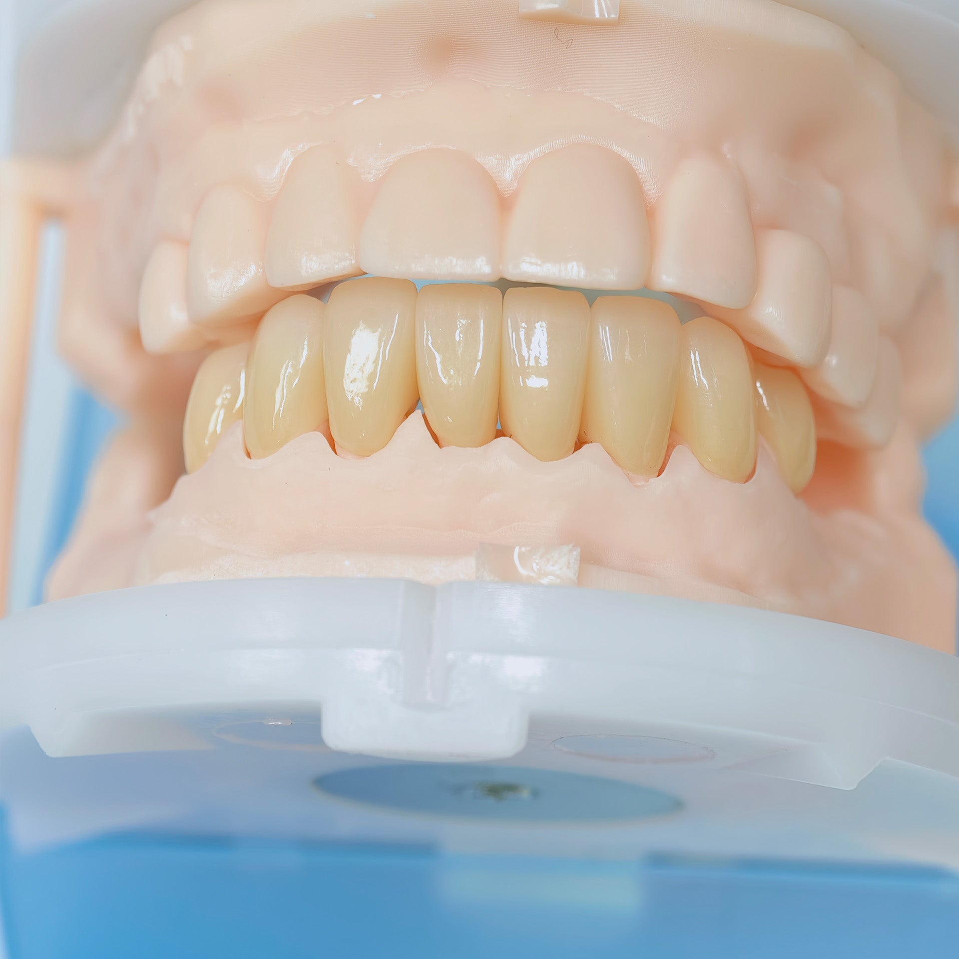 High - Strength Zirconia Crowns