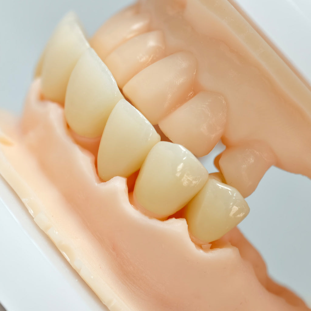 High - Strength Zirconia Crowns