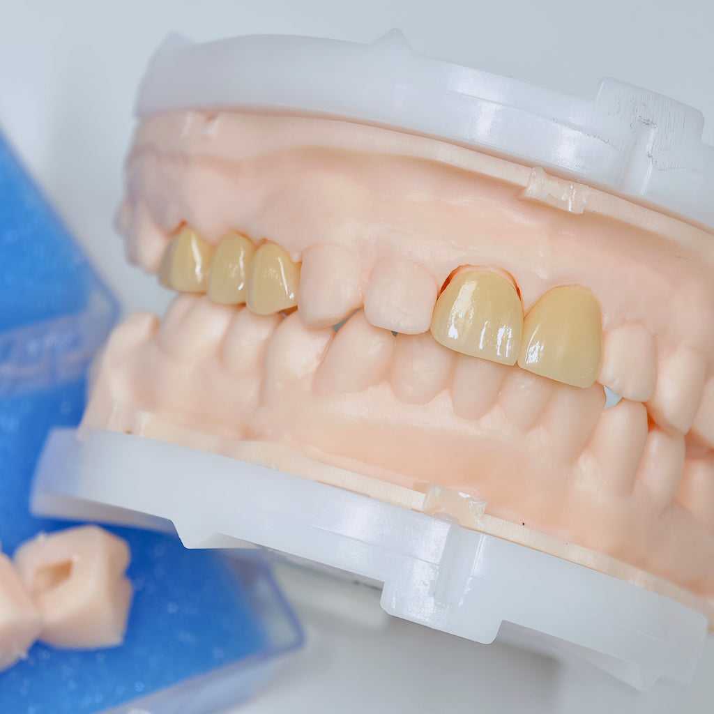 High - Strength Zirconia Crowns