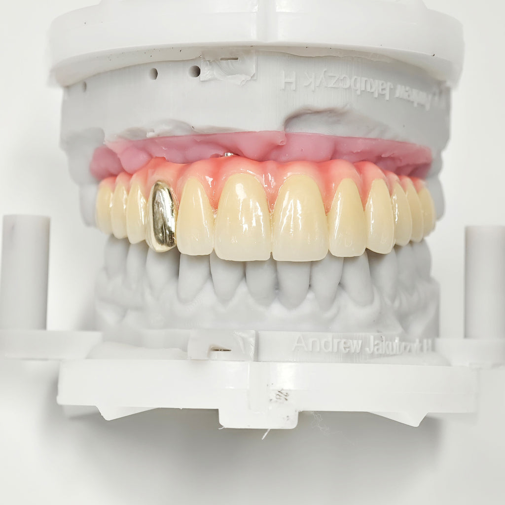 Malo Bridge With Gold-Plated Titanium Framework And A Gold Crown