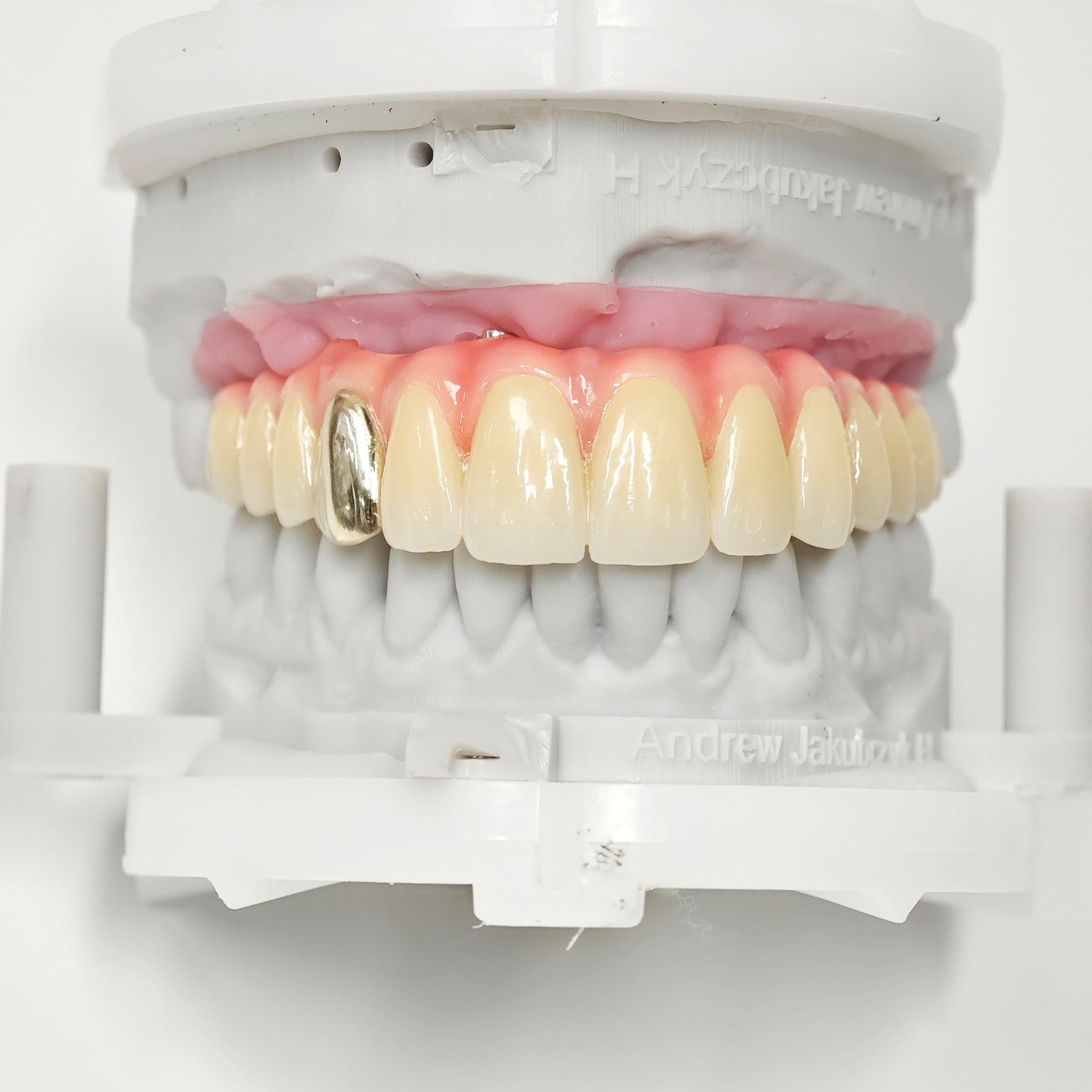 Malo Bridge With Gold-Plated Titanium Framework And A Gold Crown