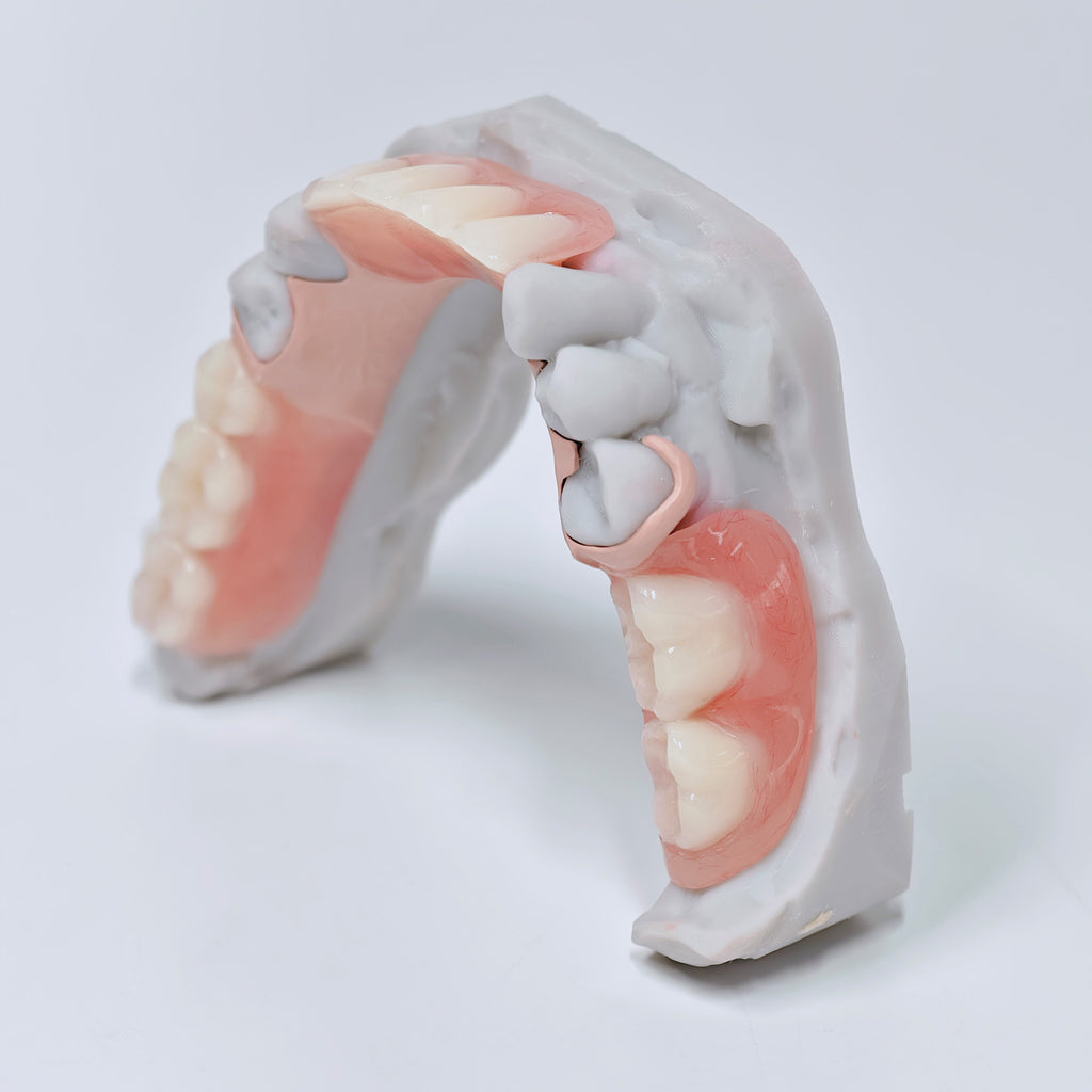 PEEK Framework Denture Metal Framework With Acrylic Denture