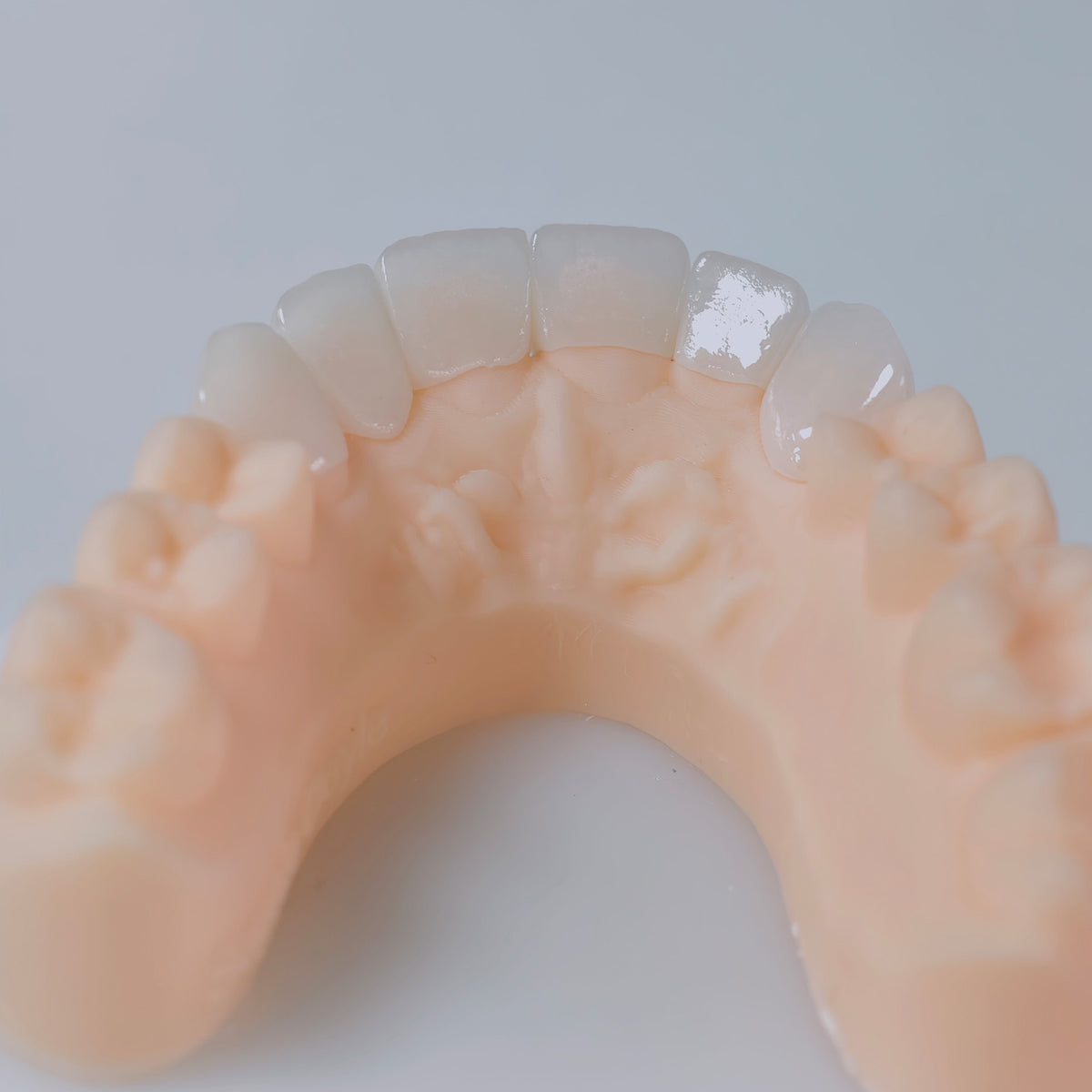 PFZ Porcelain Fused Zirconia Aidite Zirconia