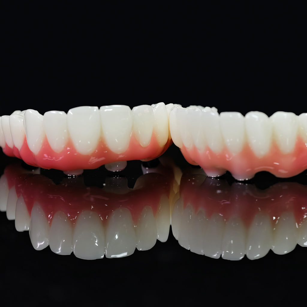 PMMA Bridge With Ti-Base Screw Retained Trying For Full Arch Restoration