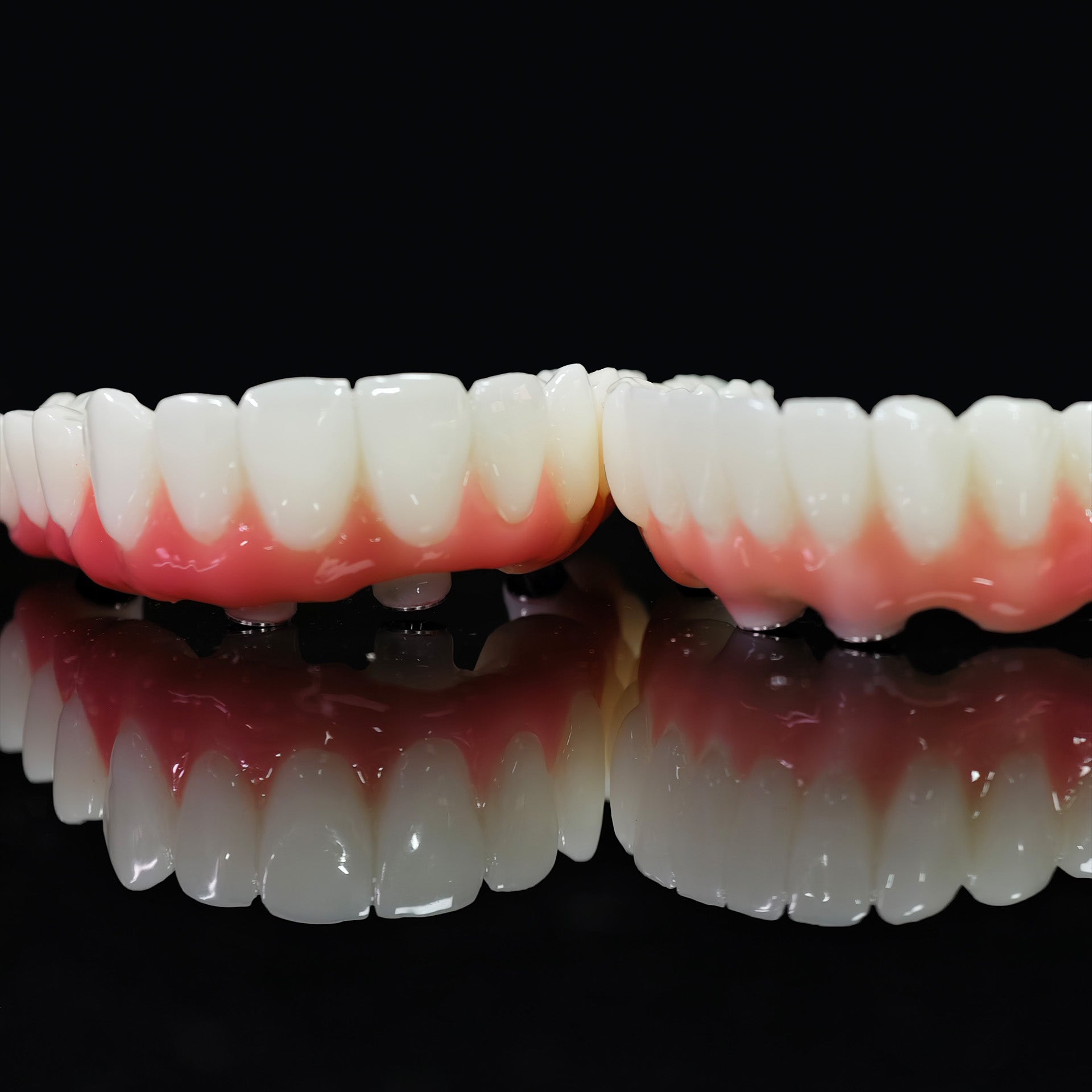 PMMA Bridge With Ti-Base Screw Retained Trying For Full Arch Restoration