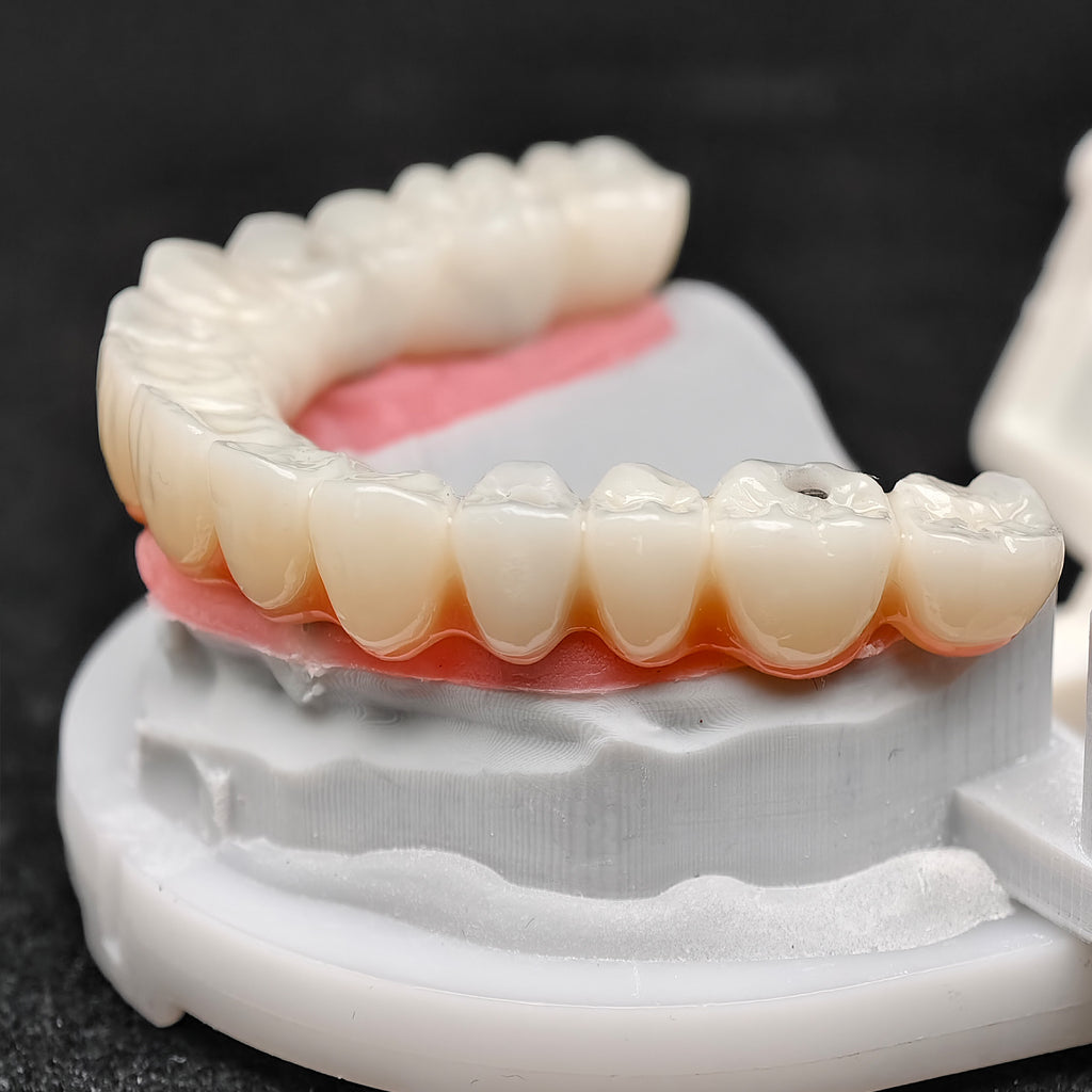 PMMA Bridge With Ti-Base Screw Retained Trying For Full Arch Restoration