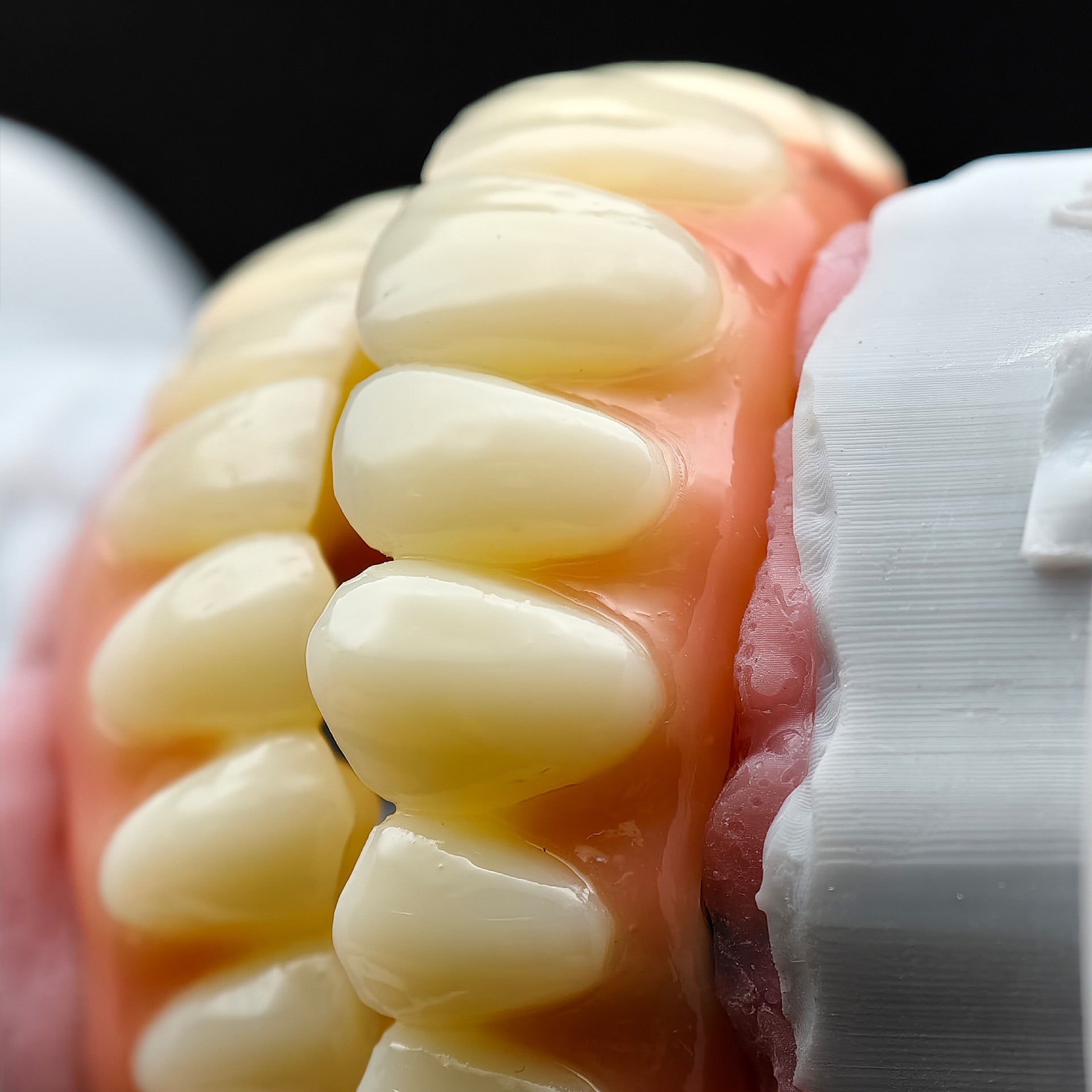 PMMA Bridge With Ti-Base Screw Retained Trying For Full Arch Restoration