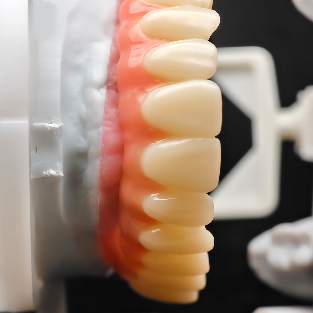 PMMA Bridge With Ti-Base Screw Retained Trying For Full Arch Restoration