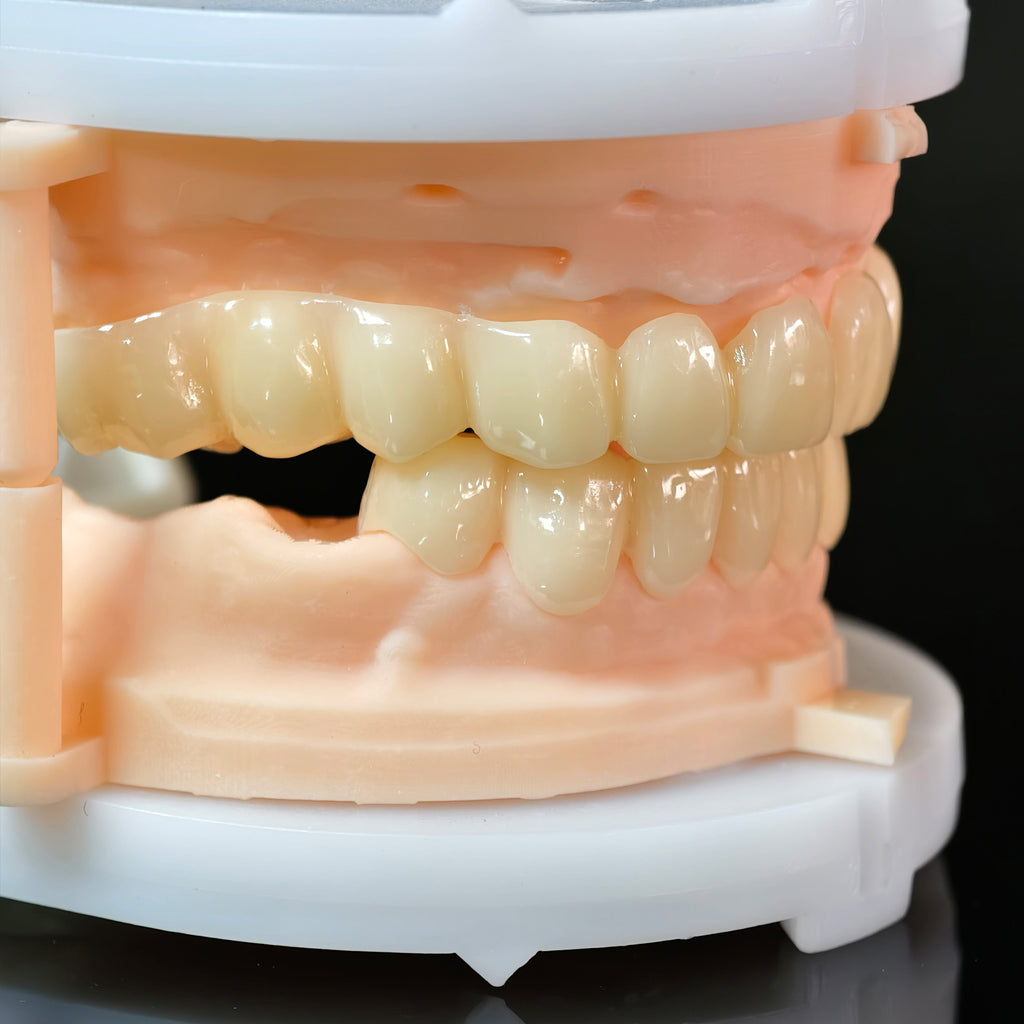 PMMA Bridge With Open Shell Preparing For Full Arch Dental Implants