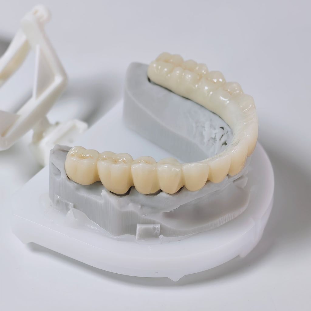 Ti-Bar Titanium Nitride Metal Frame With Zirconia Bridge And Cement Retained