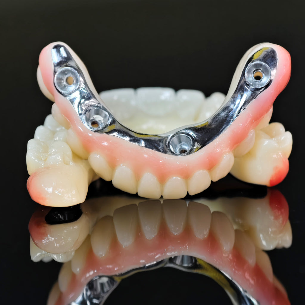 Ti-Bar Titanium Nitride Metal Frame With Zirconia Bridge For Full Arch Restoration