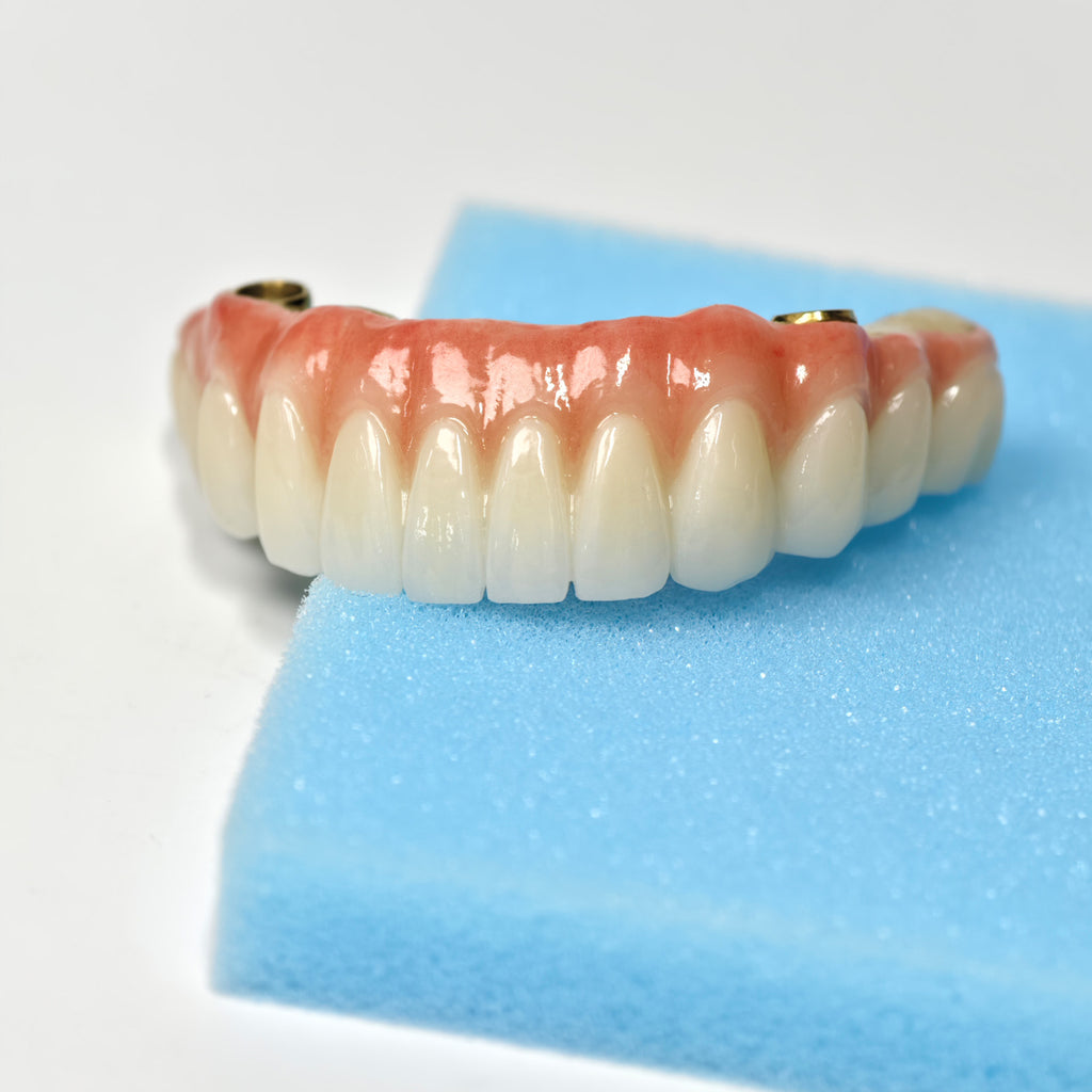 Ti-Bar Titanium Nitride Metal Frame With Zirconia Bridge For Full Arch Restoration
