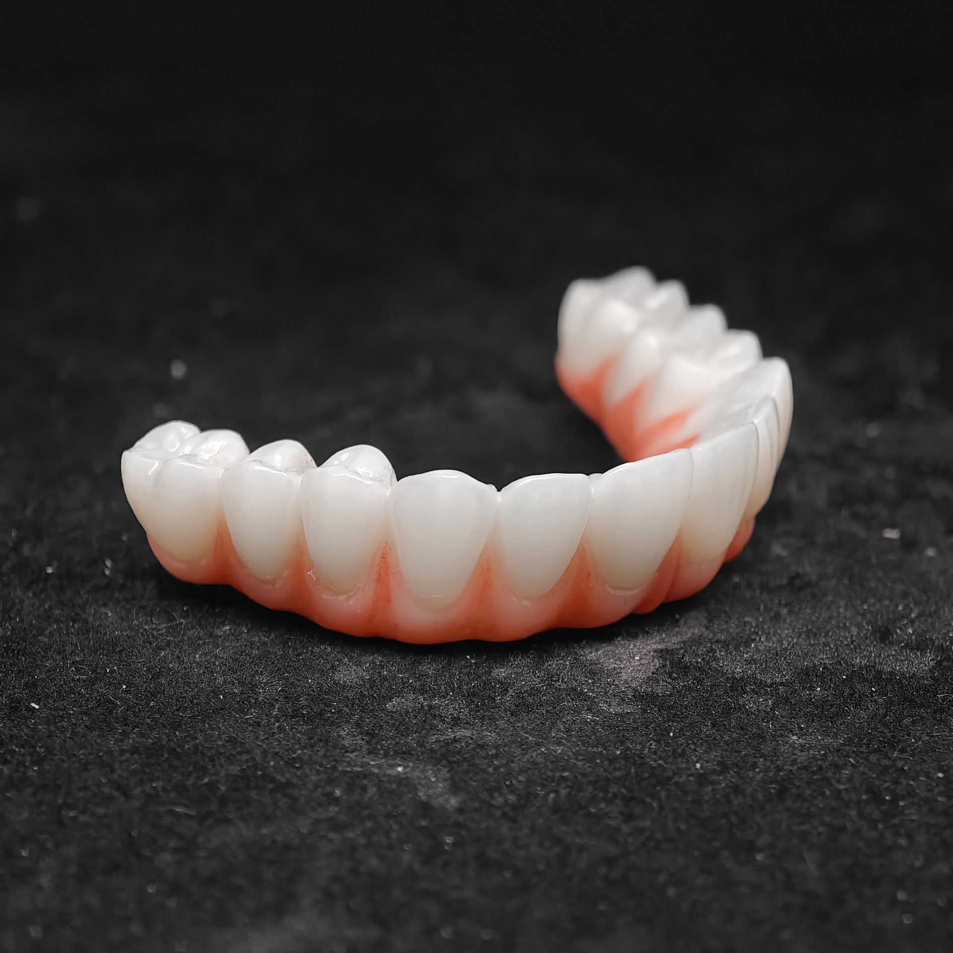 Ti-Bar Titanium Nitride Metal Frame With Zirconia Bridge For Full Arch Restoration