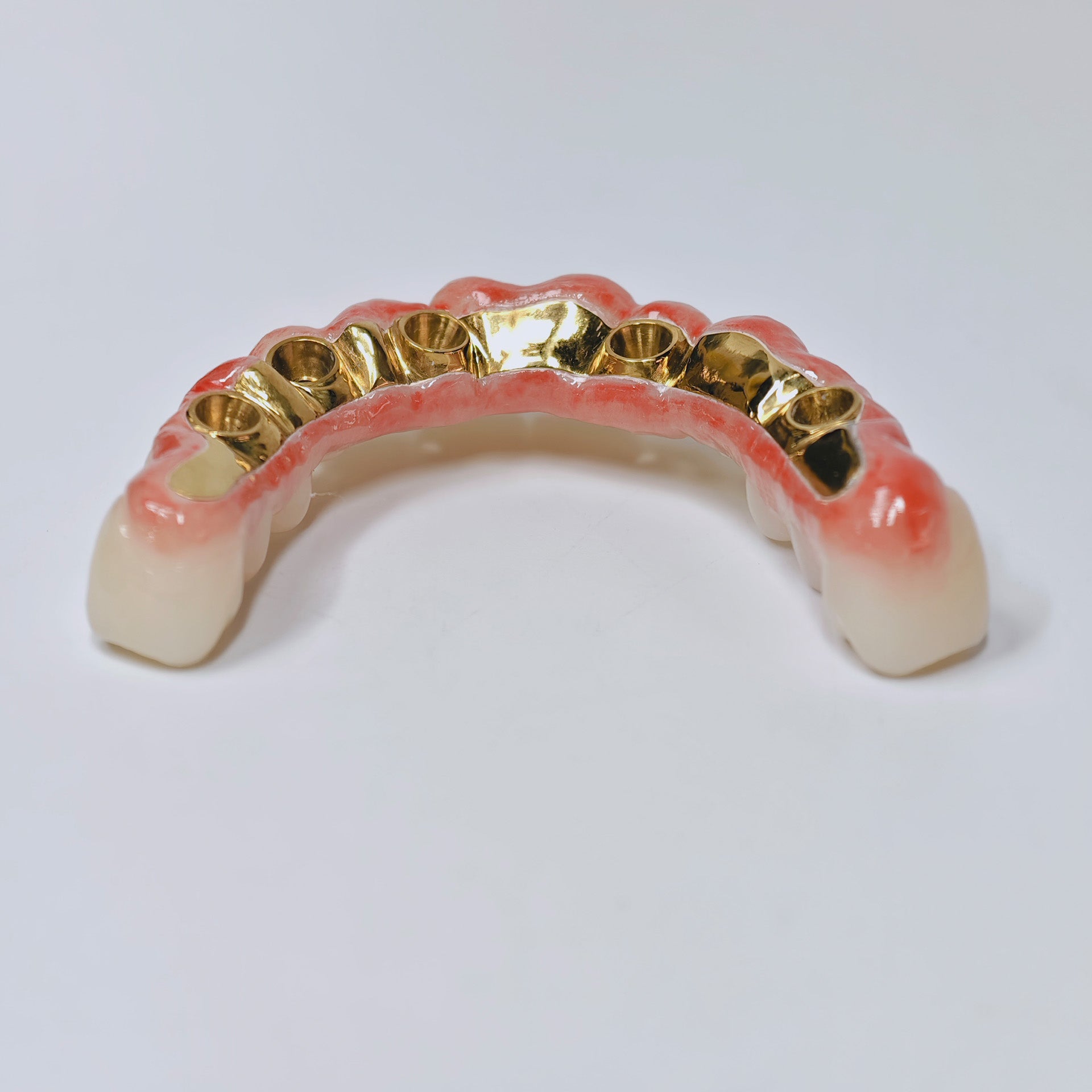 Ti-Bar Titanium Nitride Metal Frame With Zirconia Bridge For Full Arch Restoration