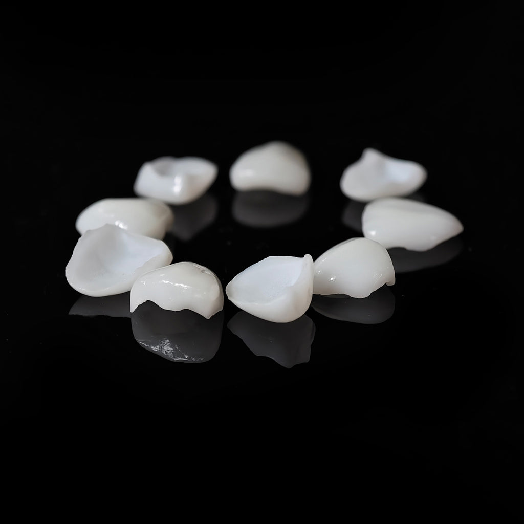 Ultra-Thin Emax Veneer. High Transparency/Translucent, Natural Shade