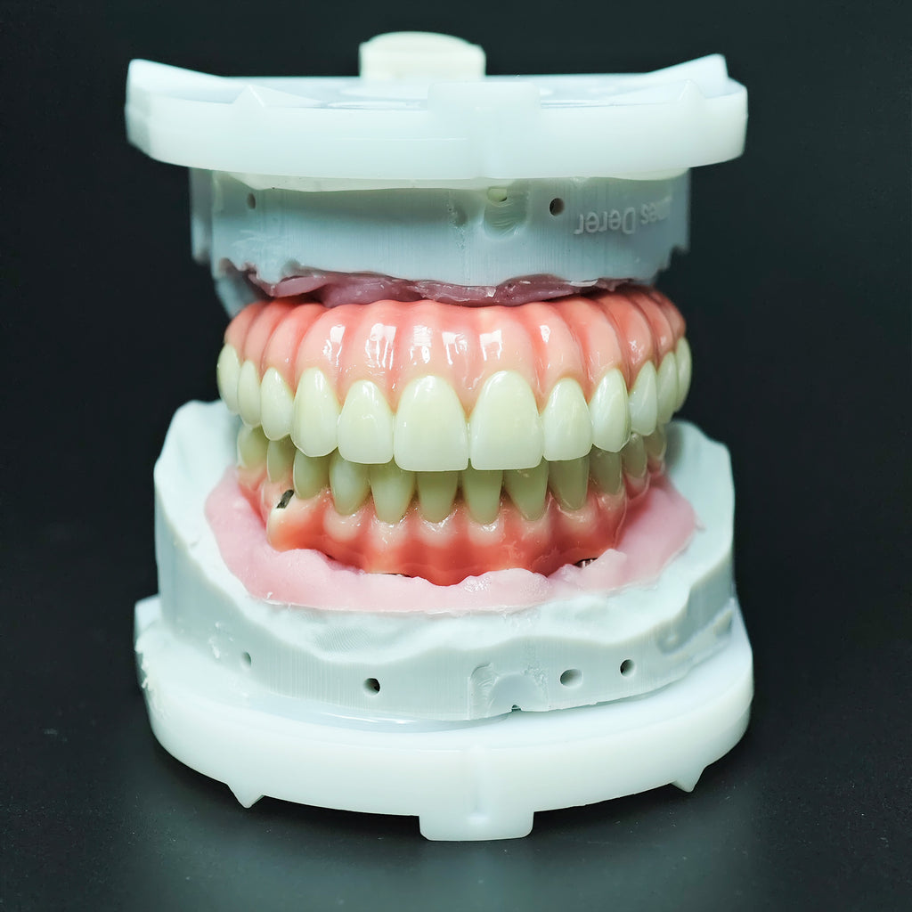 Zirconia-Enamel Hybrid Malo Bridge