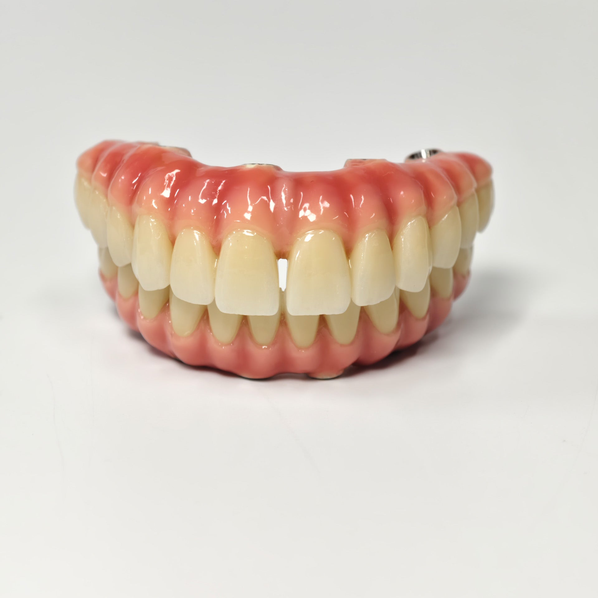 Zirconia-Enamel Hybrid Malo Bridge