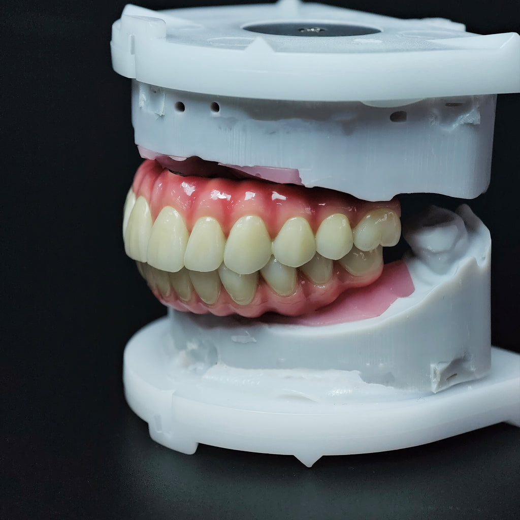 Zirconia-Enamel Hybrid Malo Bridge