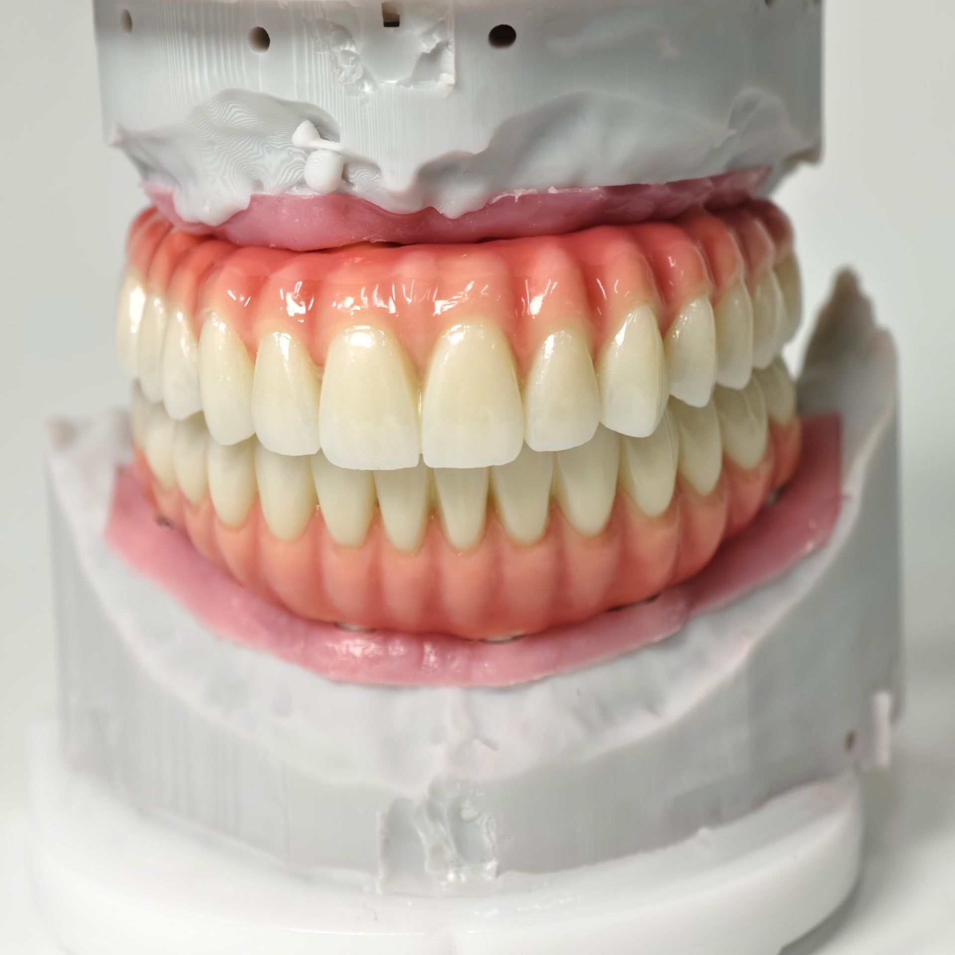 Zirconia-Enamel Hybrid Malo Bridge