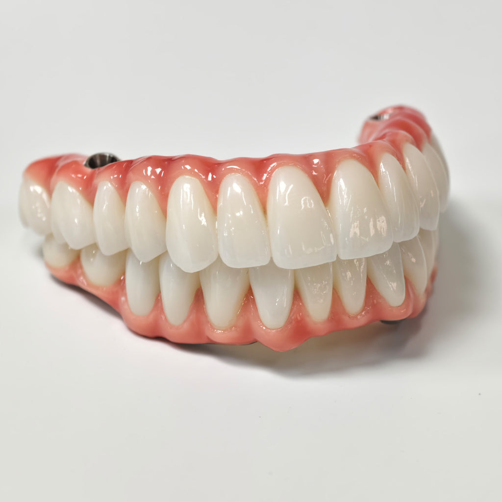 Zirconia-Enamel Hybrid Malo Bridge