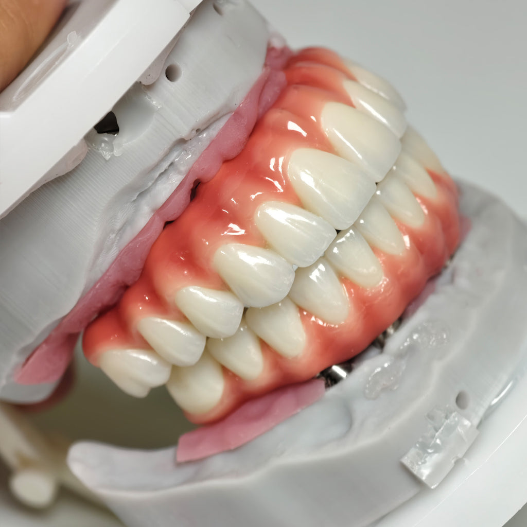 Zirconia-Enamel Hybrid Malo Bridge