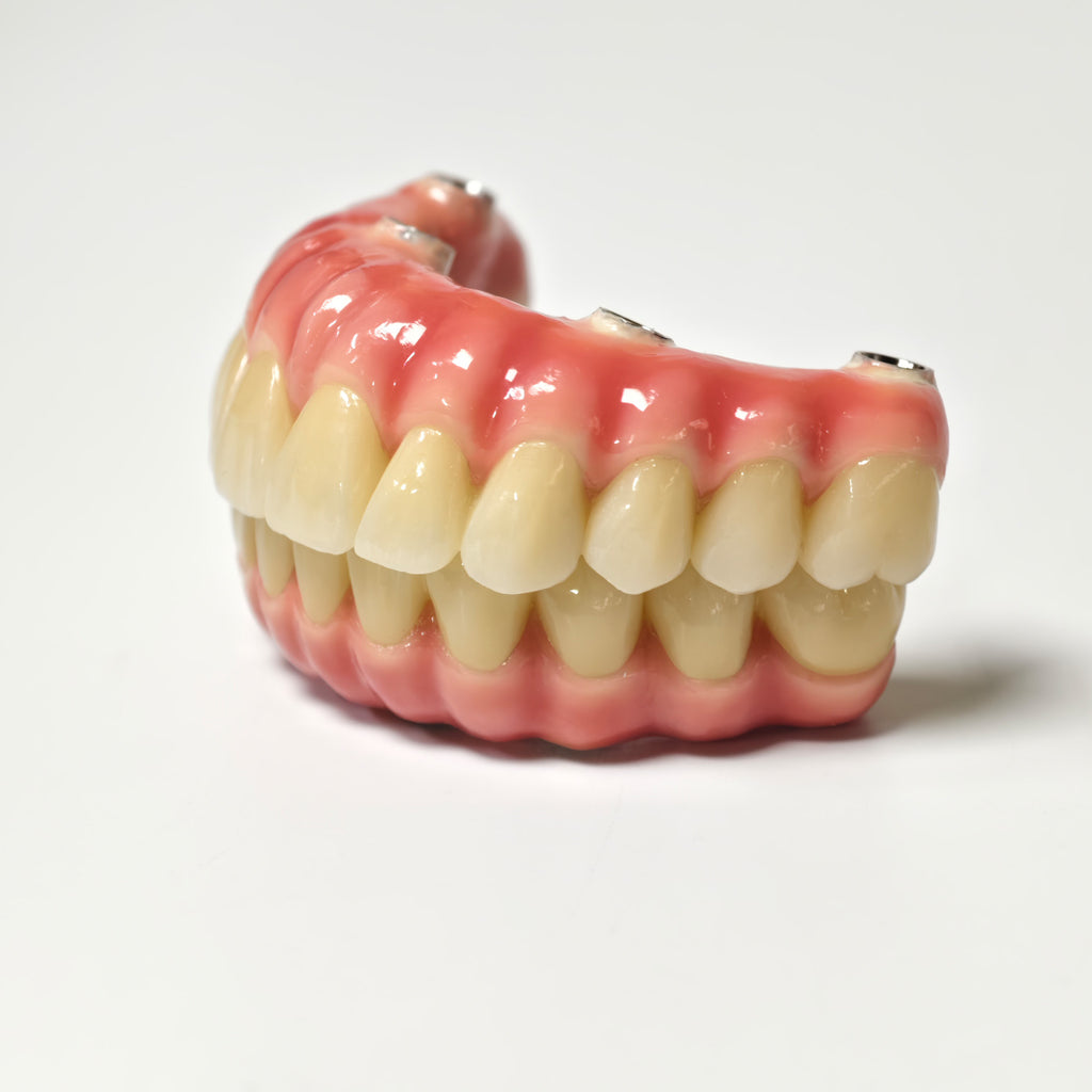 Zirconia-Enamel Hybrid Malo Bridge