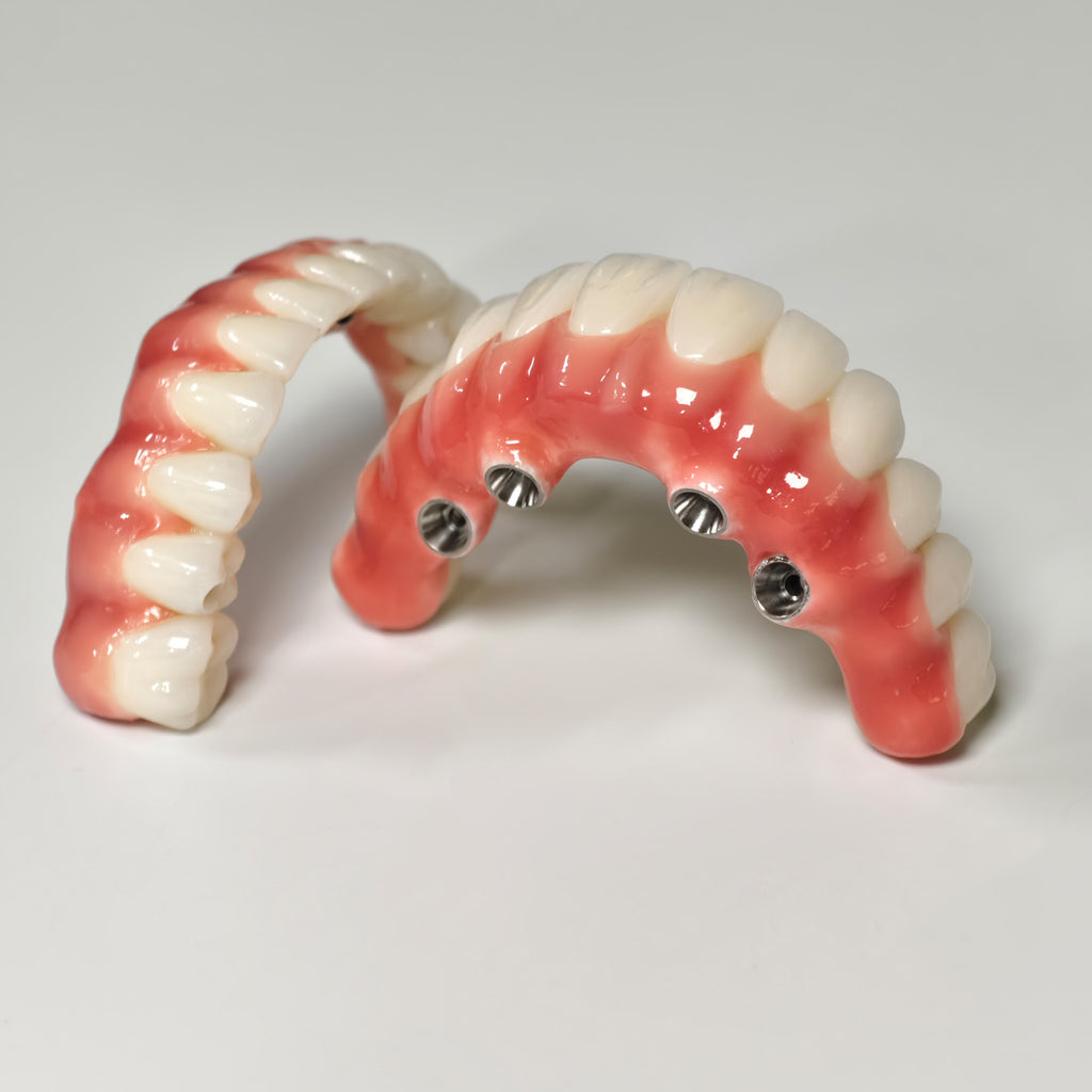 Zirconia-Enamel Hybrid Malo Bridge