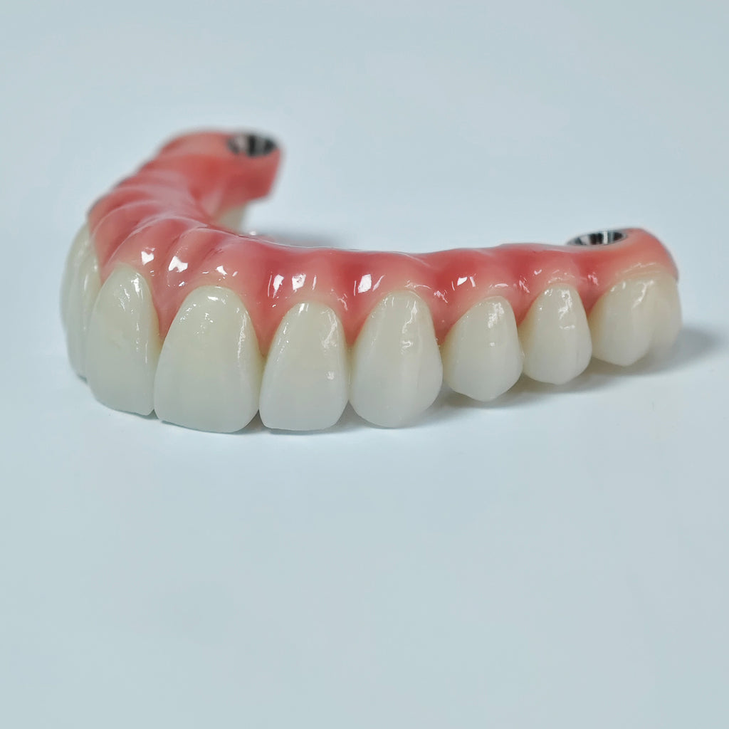 Zirconia-Enamel Hybrid Malo Bridge