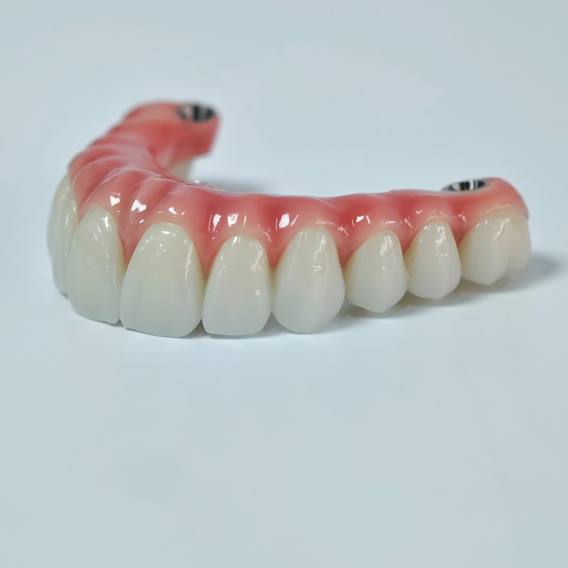 Zirconia-Enamel Hybrid Malo Bridge