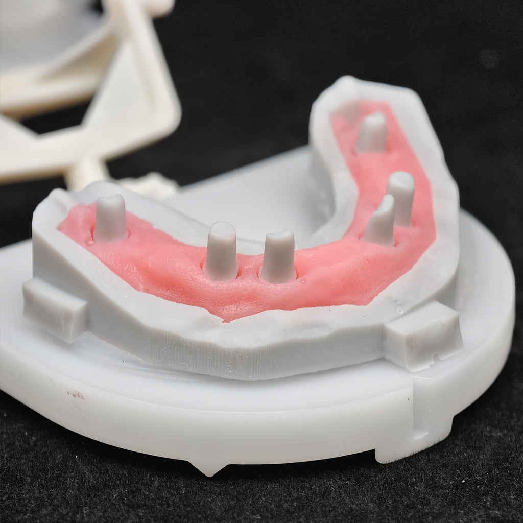 Zirconia Bridge With Cement Retained