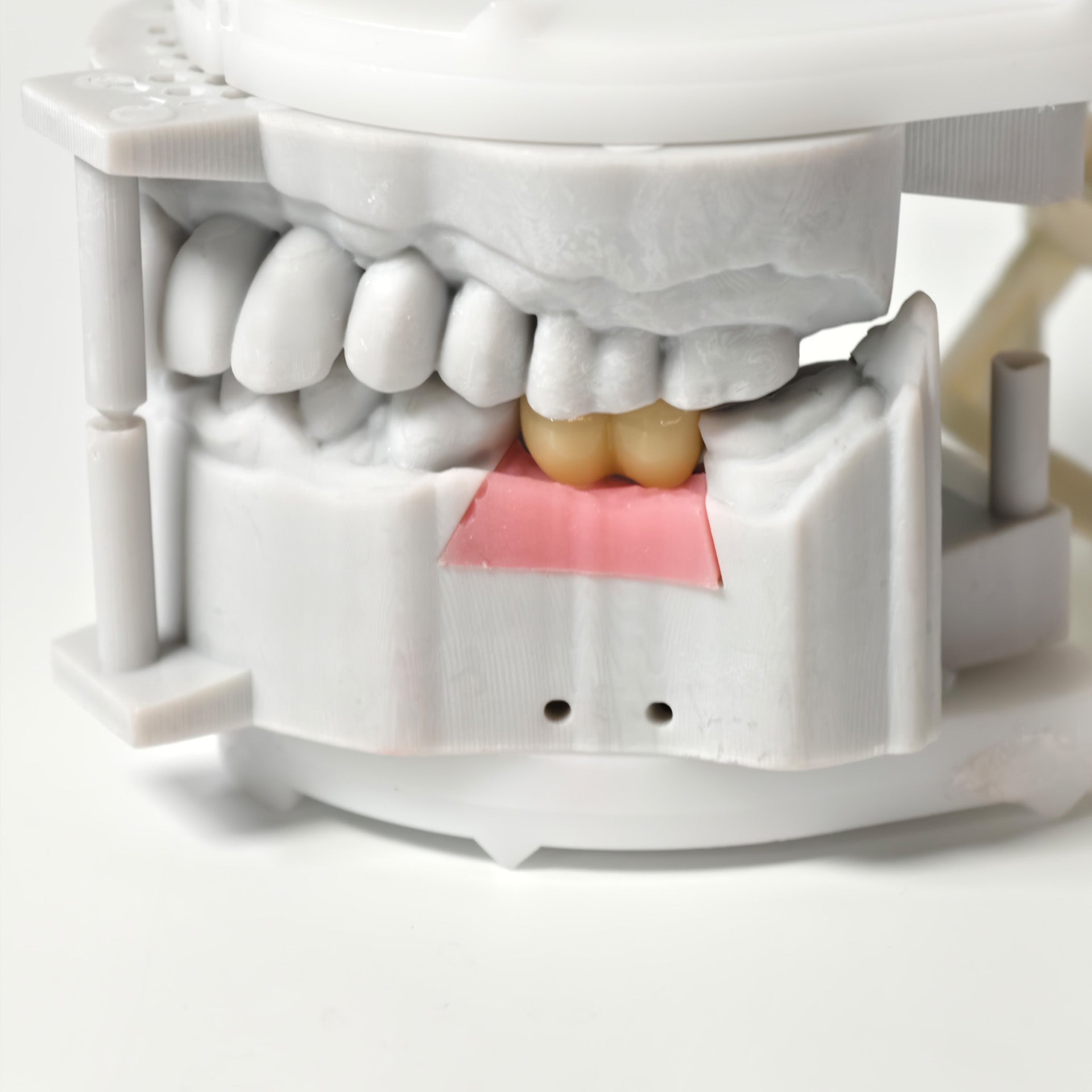 Zirconia Implant Bridge Screwmentable Dental Crown