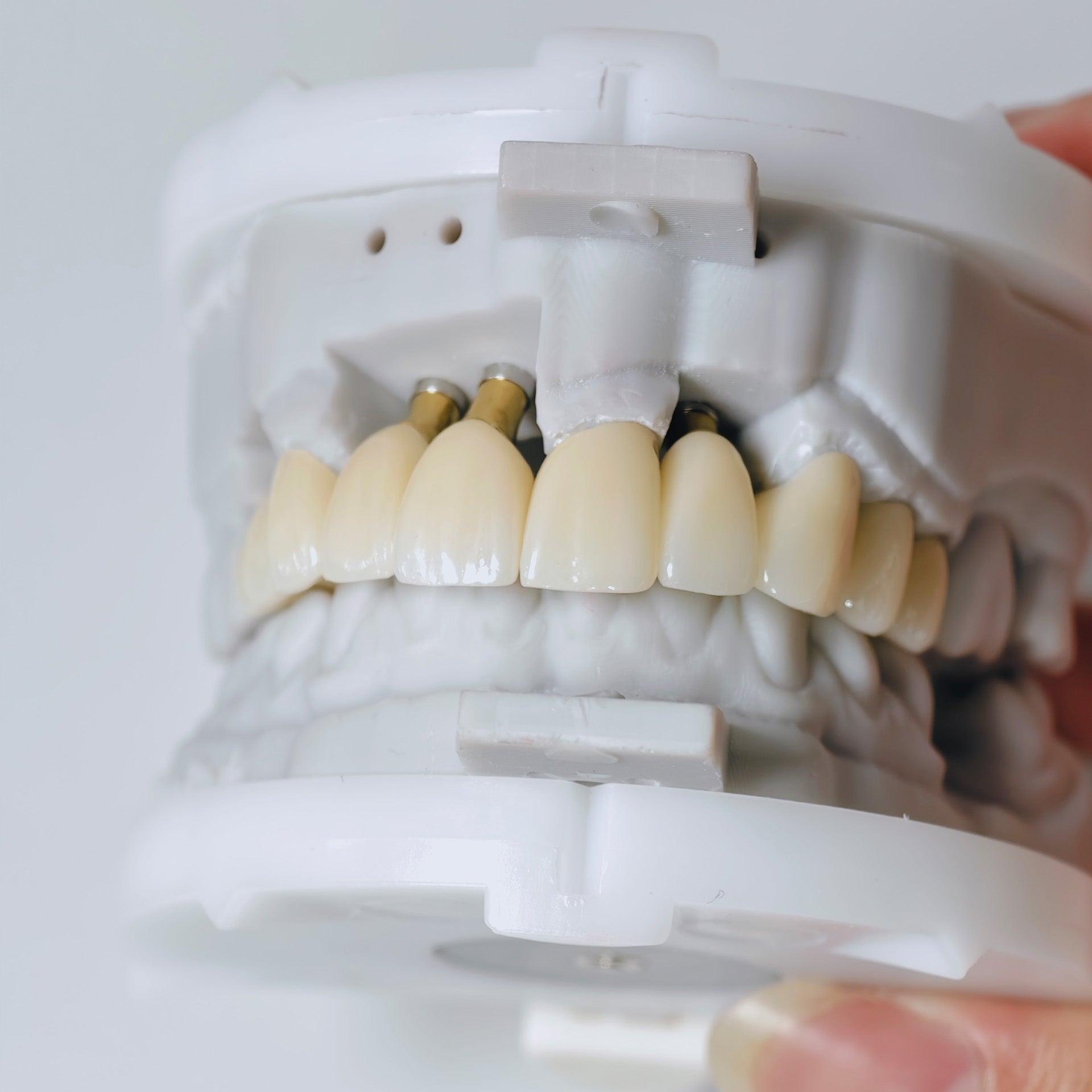Zirconia Implant Crown And Bridge Screwmentable Dental Crown