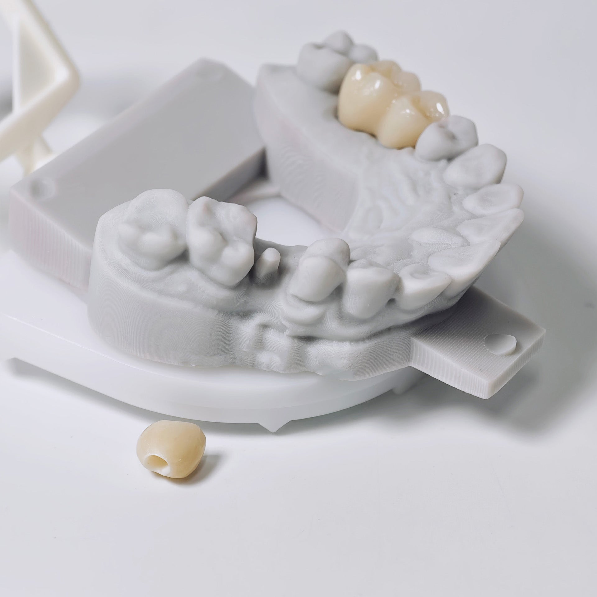 Zirconia Implant Crowns And Bridges Screwmentable Dental Crown