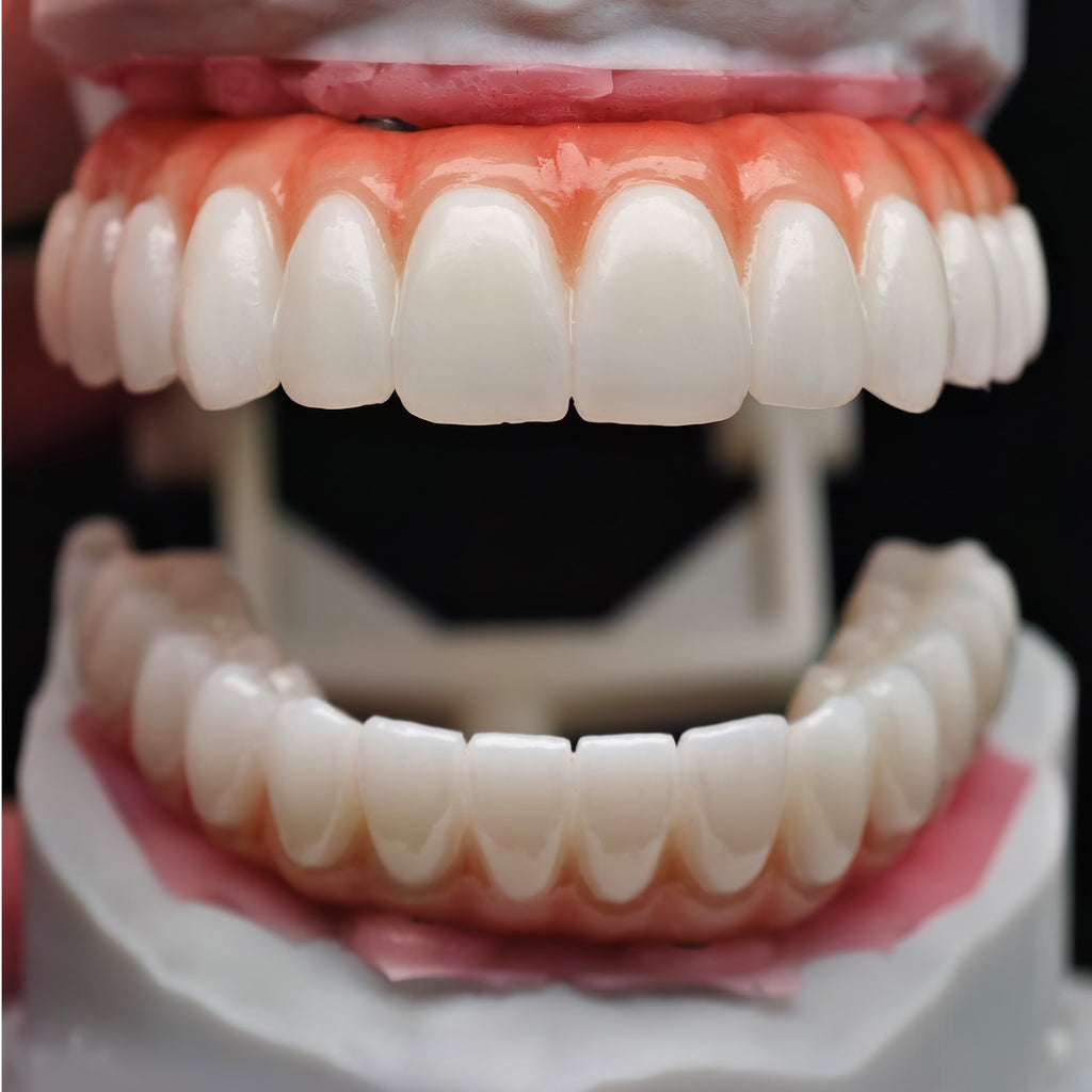 All On 4 Zirconia Bridge With Ti-Base Screw Retained Trying For Full Arch Restoration
