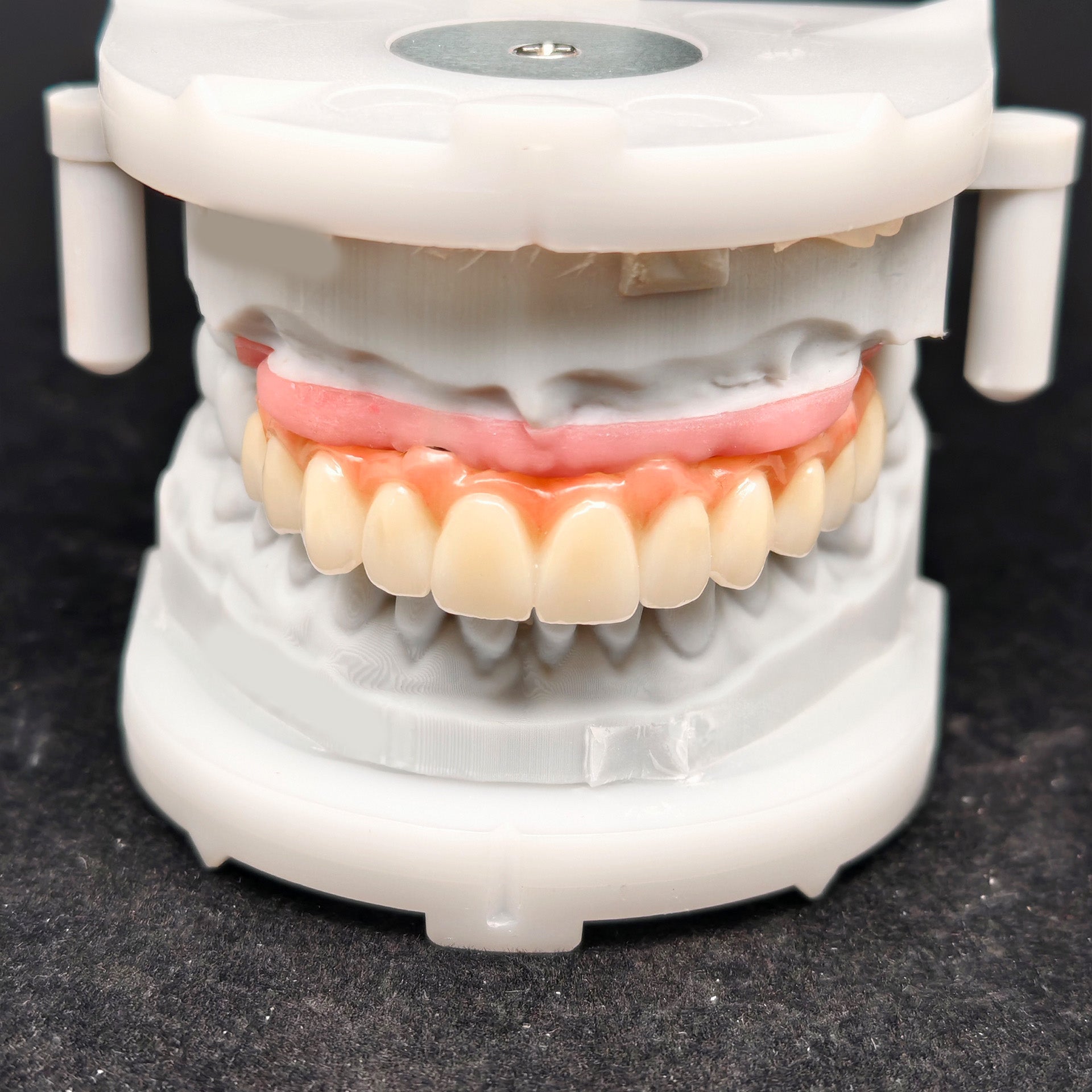 All On 4 Zirconia Bridge With Ti-Base Screw Retained Trying For Full Arch Restoration