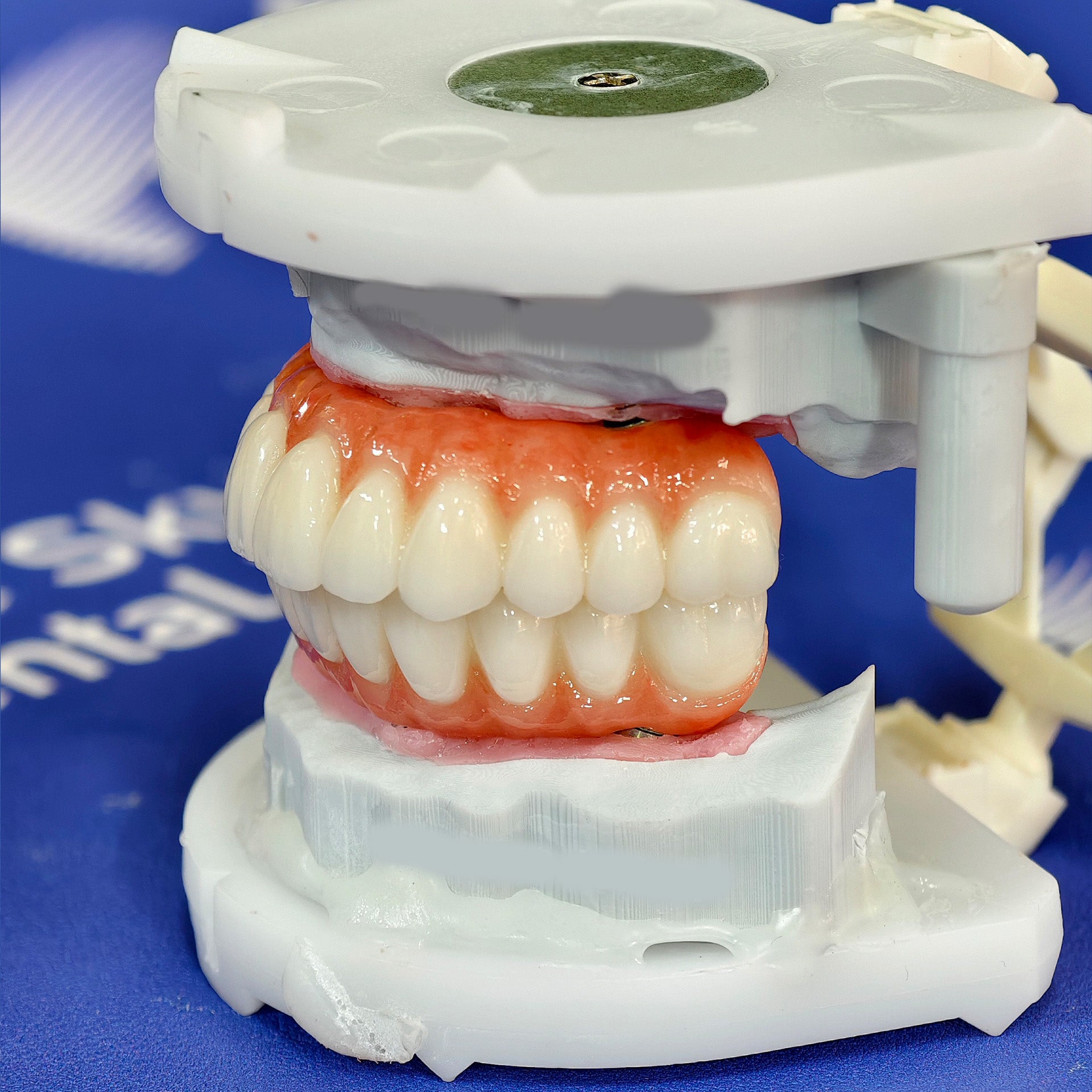 All On 4 Zirconia Bridge With Ti-Base Screw Retained Trying For Full Arch Restoration