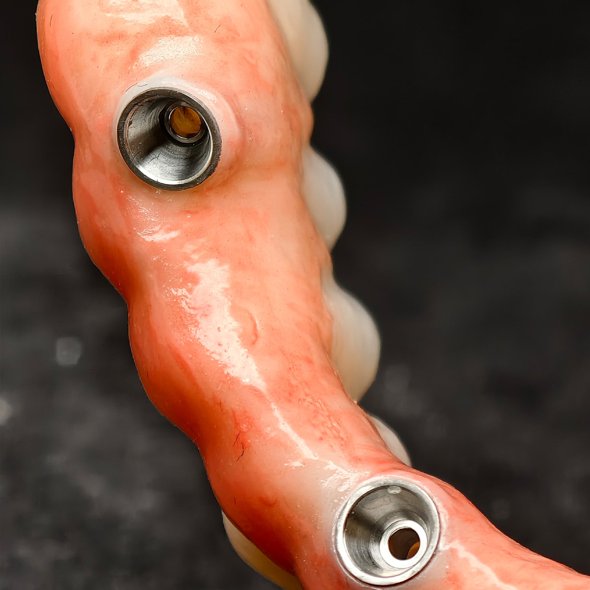 All On 4 Zirconia Bridge With Ti-Base Screw Retained Trying For Full Arch Restoration