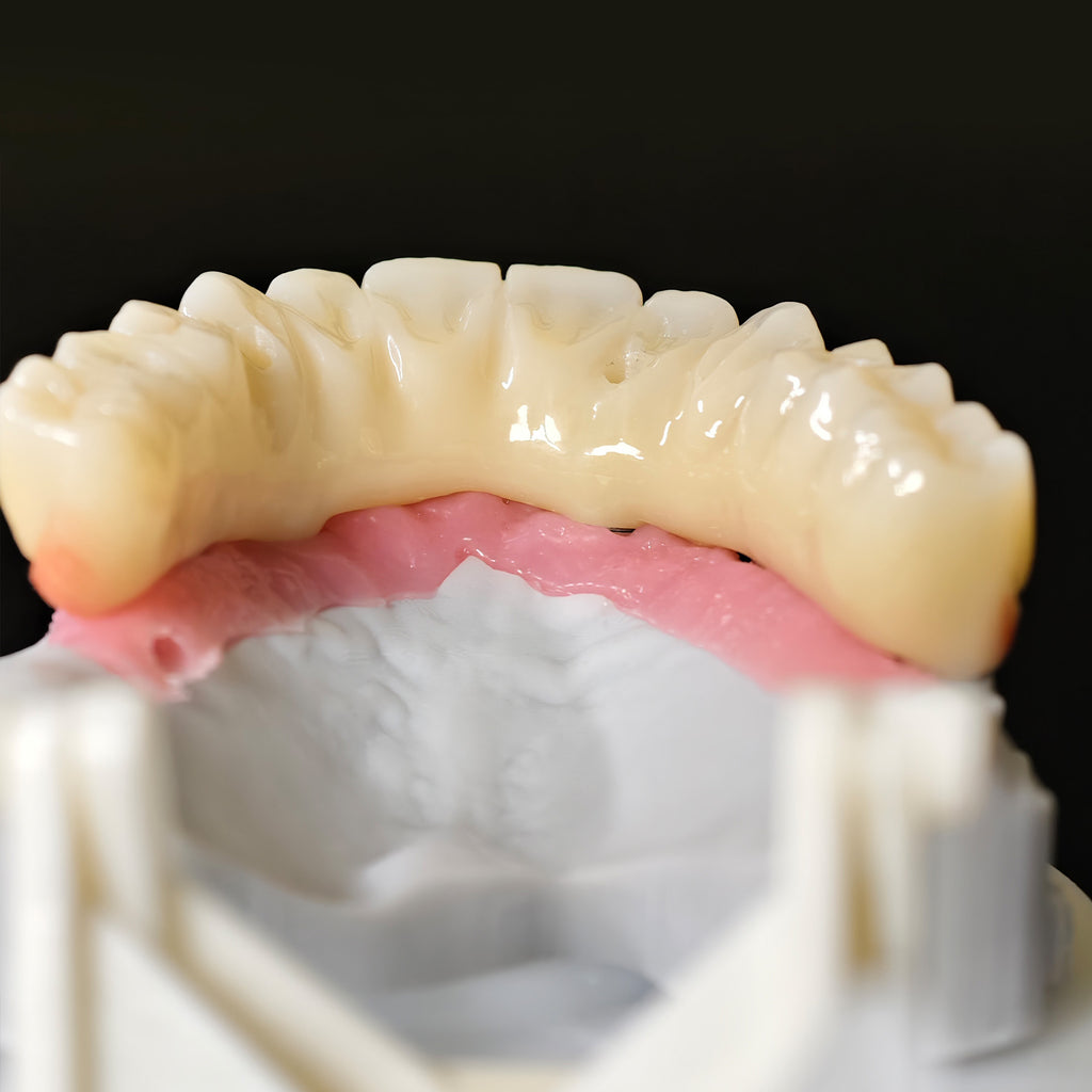 All On 5 Zirconia Bridge With Ti-Base Screw Retained Trying For Full Arch Restoration