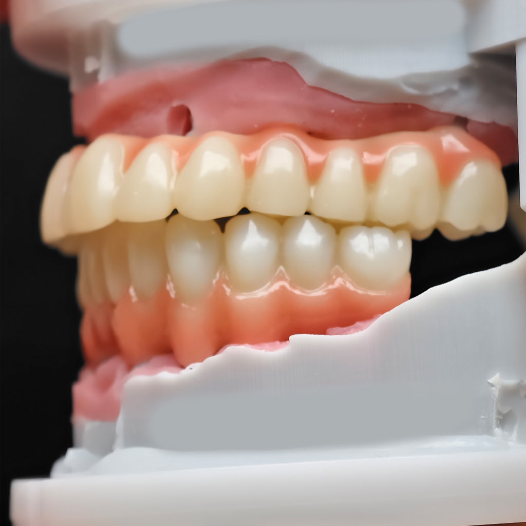 Pmma Bridge And Zirconia Bridge With Cemented