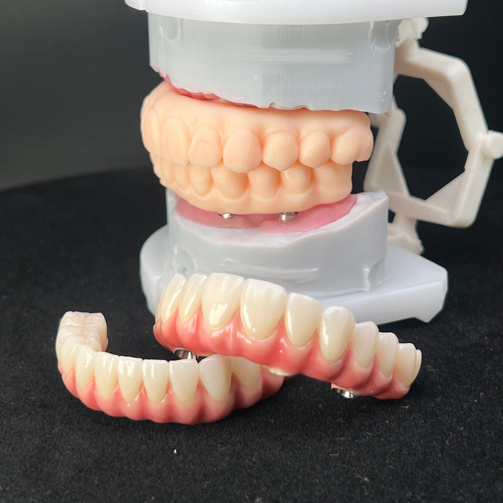 Malo Bridge With Zirconia Crowns Screw Retained Made In Dental Lab