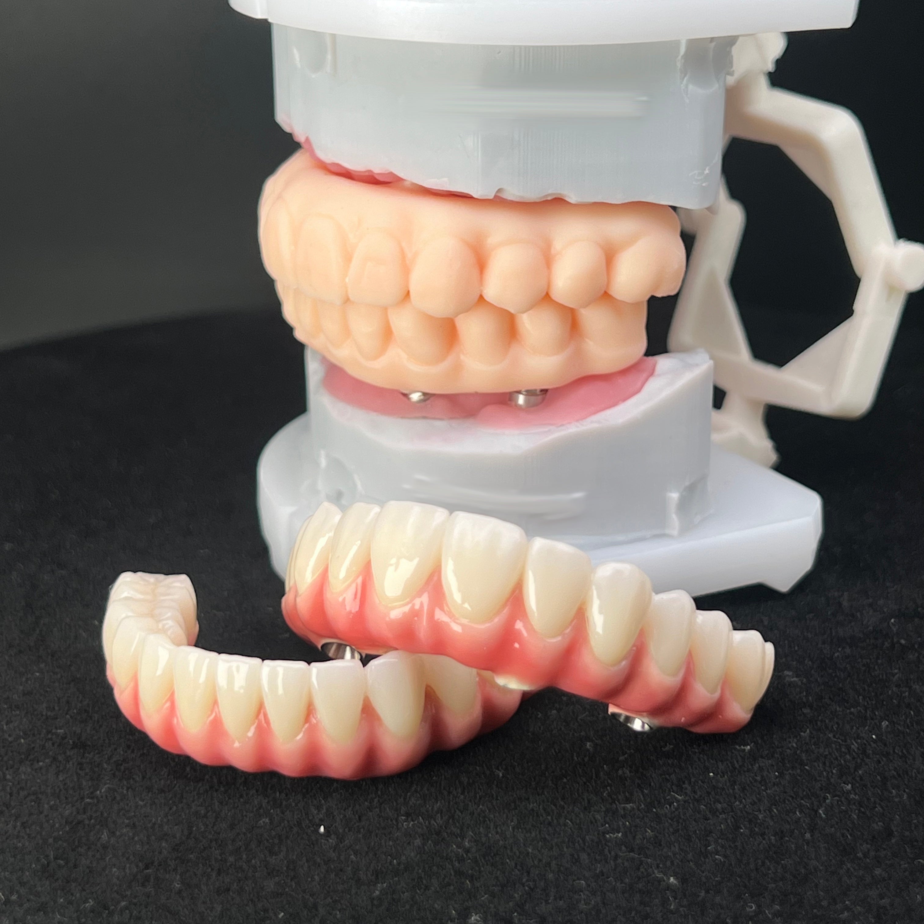 Malo Bridge With Zirconia Crowns Screw Retained Made In Dental Lab