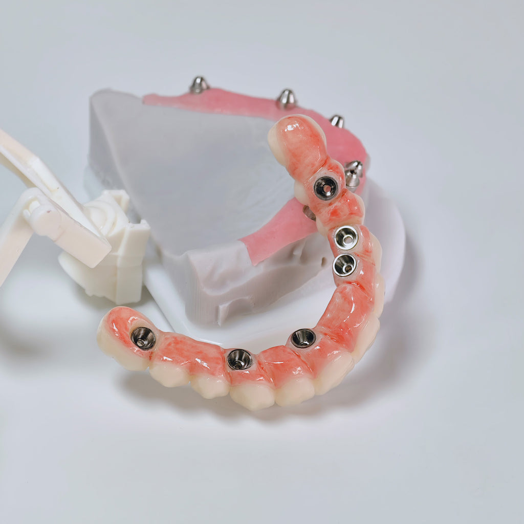 All On 6 Zirconia Bridge With Ti-Base Screw Retained