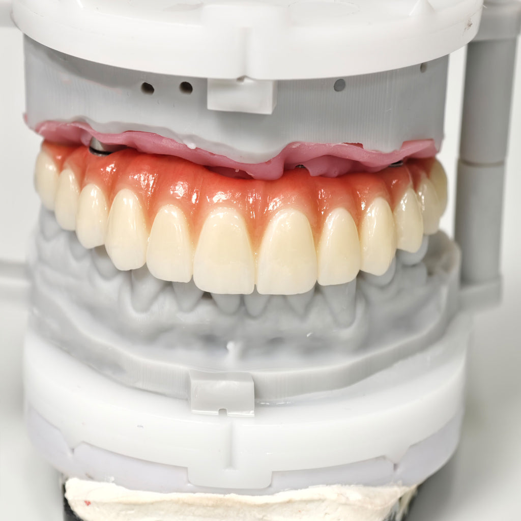 All On 6 Zirconia Bridge With Ti-Base Screw Retained