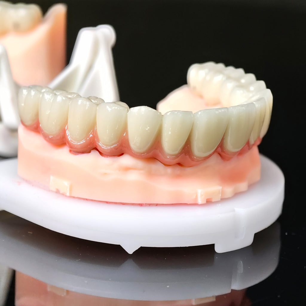 Co - Cr PFM Dental Bridge