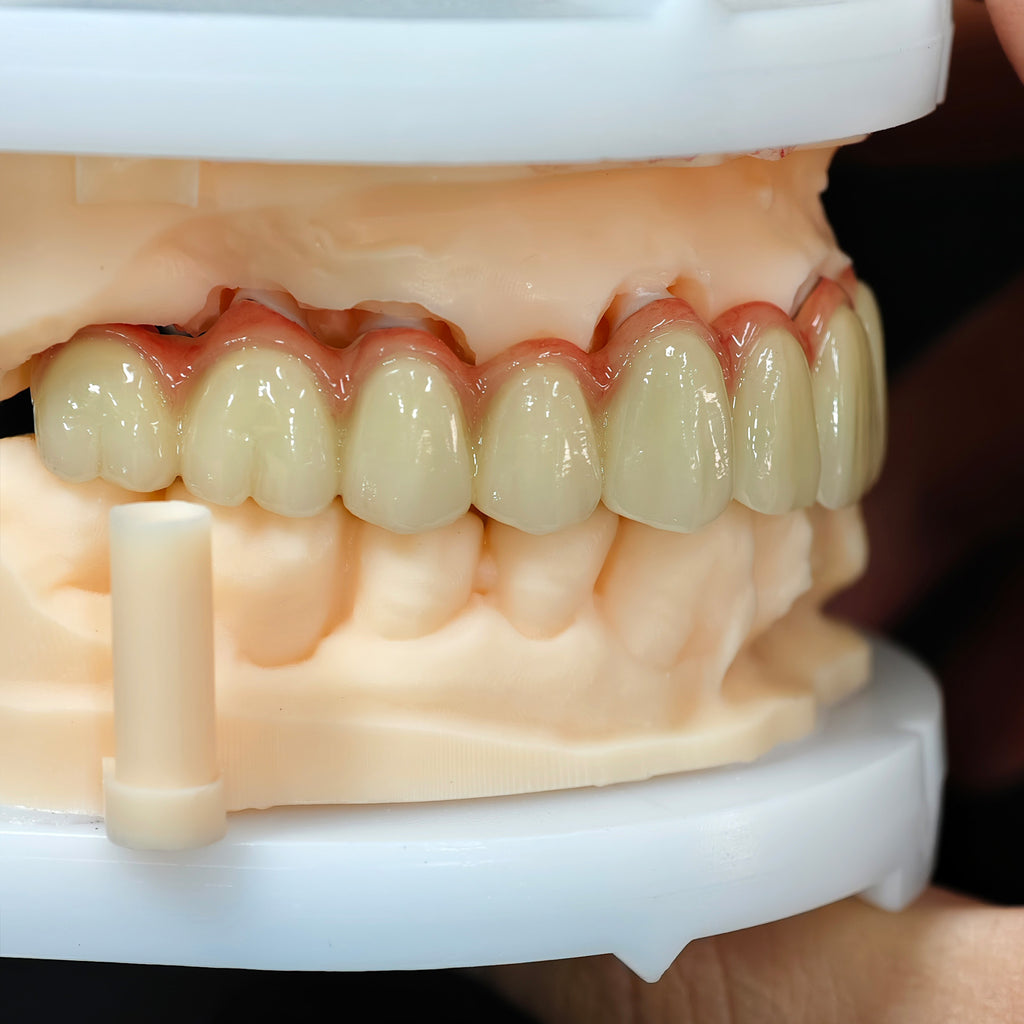 Co - Cr PFM Dental Bridge