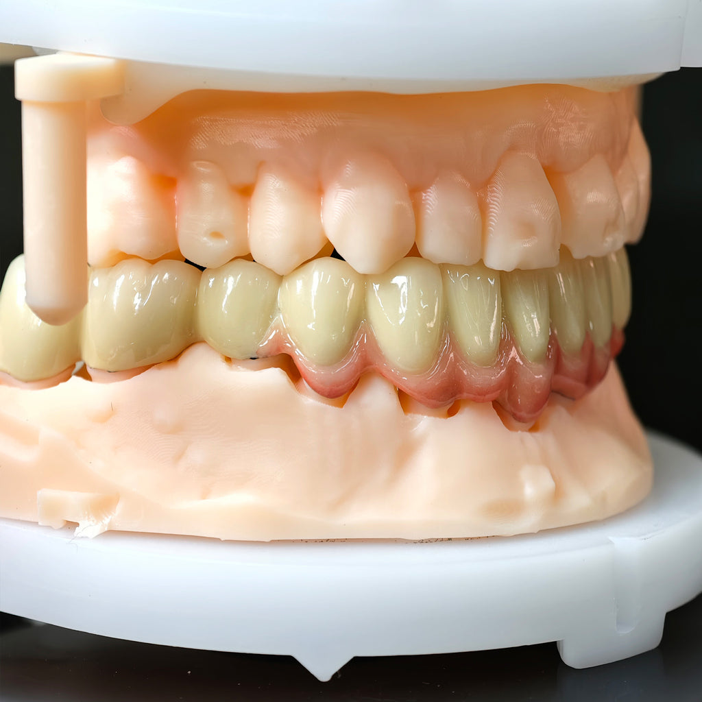 Co - Cr PFM Dental Bridge